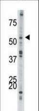 The anti-ACVR1B antibody is used in Western blot to detect ACVR1B in mouse kidney tissue lysate.