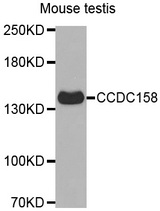 Western blot analysis of extracts of Mouse testis cell line, using CCDC158 antibody.