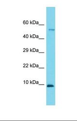 Western blot of Mouse Small Intestine. 1110021J02Rik antibody dilution 1.0 ug/ml.