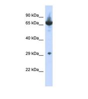 Western blot of Human HepG2. CCDC17 antibody dilution 1.0 ug/ml.
