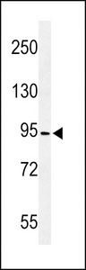 Western blot of CF097 Antibody in MDA-MB435 cell line lysates (35 ug/lane). CF097 (arrow) was detected using the purified antibody.