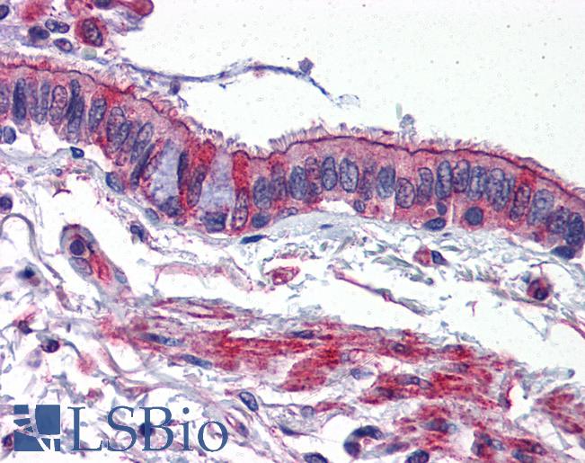 Anti-ACVR1 antibody IHC of human lung. Immunohistochemistry of formalin-fixed, paraffin-embedded tissue after heat-induced antigen retrieval. Antibody LS-B2695 concentration 5 ug/ml.
