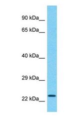 Western blot of CCDC183 Antibody with human Placenta lysate.