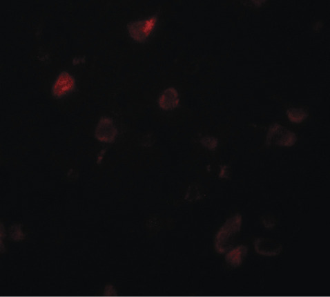 Immunofluorescence of CCDC22 in human brain tissue with CCDC22 antibody at 20 ug/ml.
