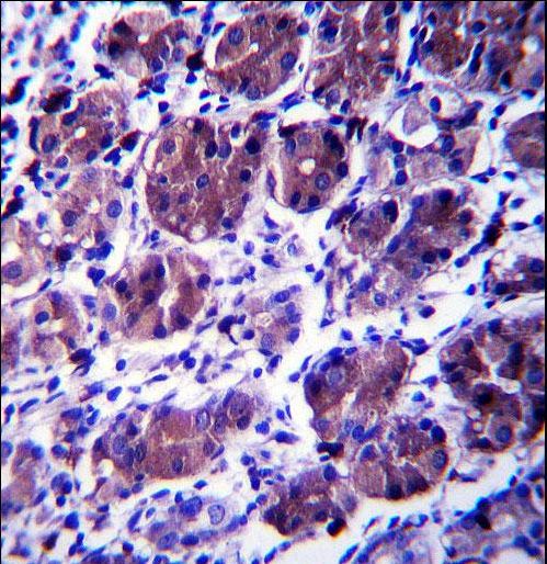 CCDC22 Antibody immunohistochemistry of formalin-fixed and paraffin-embedded human stomach tissue followed by peroxidase-conjugated secondary antibody and DAB staining.