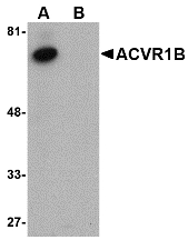 Western blot of ACVR1B in human kidney tissue lysate with ACVR1B antibody at 1 ug/ml in (A) the absence and (B) the presence of blocking peptide.