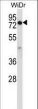 CCDC22 Antibody western blot of WiDr cell line lysates (35 ug/lane). The CCDC22 antibody detected the CCDC22 protein (arrow).