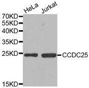 Western blot analysis of extracts of various cell lines, using CCDC25 antibody.