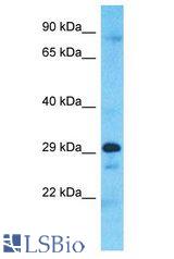 CCDC28A antibody Western Blot of A549. Antibody dilution: 1 ug/ml.