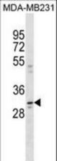 CCDC28A Antibody western blot of MDA-MB231 cell line lysates (35 ug/lane). The CCDC28A Antibody detected the CCDC28A protein (arrow).