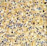 Formalin-fixed and paraffin-embedded human spleen reacted with CCDC3 Antibody , which was peroxidase-conjugated to the secondary antibody, followed by DAB staining. This data demonstrates the use of this antibody for immunohistochemistry; clinical relevance has not been evaluated.