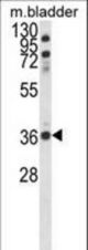 Western blot of CCDC3 Antibody in mouse bladder tissue lysates (35 ug/lane). CCDC3 (arrow) was detected using the purified antibody.