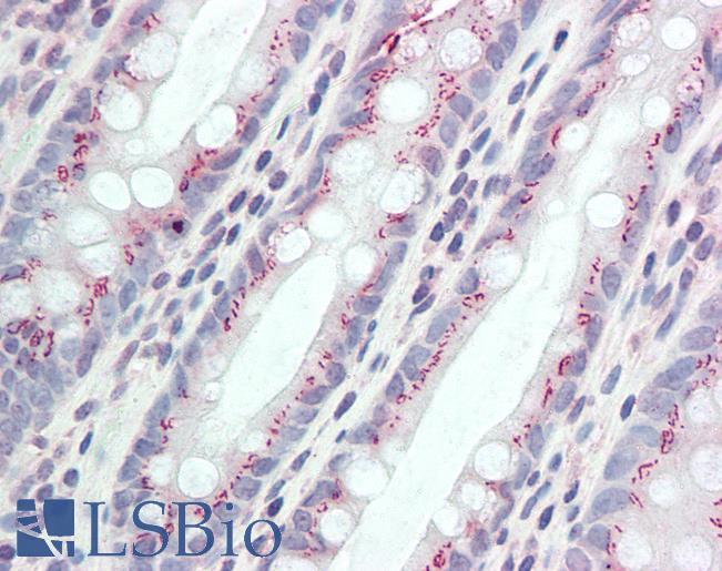 Anti-CCDC3 antibody IHC staining of human colon. Immunohistochemistry of formalin-fixed, paraffin-embedded tissue after heat-induced antigen retrieval. Antibody LS-B10517 concentration 5 ug/ml.