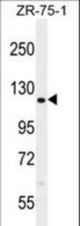 CCD33 Antibody western blot of ZR-75-1 cell line lysates (35 ug/lane). The CCD33 antibody detected the CCD33 protein (arrow).