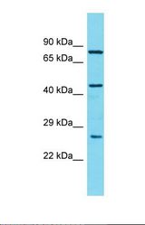 Western blot of Human OVCAR-3. CCDC34 antibody dilution 1.0 ug/ml.