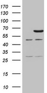 HEK293T cells were transfected with the pCMV6-ENTRY control (Left lane) or pCMV6-ENTRY CCDC36 (Right lane) cDNA for 48 hrs and lysed. Equivalent amounts of cell lysates (5 ug per lane) were separated by SDS-PAGE and immunoblotted with anti-CCDC36 (1:2000).