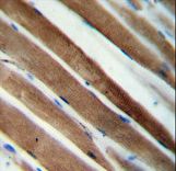 CCDC38 Antibody immunohistochemistry of formalin-fixed and paraffin-embedded human skeletal muscle followed by peroxidase-conjugated secondary antibody and DAB staining.