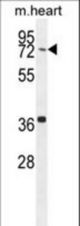 CCDC38 Antibody western blot of mouse heart tissue lysates (35 ug/lane). The CCDC38 antibody detected the CCDC38 protein (arrow).