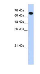 CCDC38 antibody LS-C102541 Western blot of Transfected 293T cell lysate.