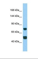 Western blot of Human Hela. CCDC39 antibody dilution 1.0 ug/ml.