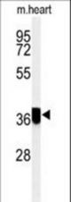 Western blot of CCDC42 Antibody in mouse heart tissue lysates (35 ug/lane). CCDC42 (arrow) was detected using the purified antibody.