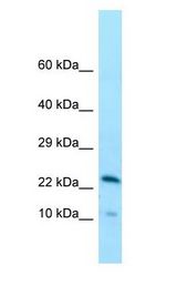 CCDC43 antibody Western Blot of Human Small Intestine.