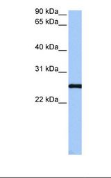 HepG2 cell lysate. Antibody concentration: 1.0 ug/ml. Gel concentration: 12%.
