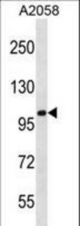 CCDC46 Antibody western blot of A2058 cell line lysates (35 ug/lane). The CCDC46 antibody detected the CCDC46 protein (arrow).