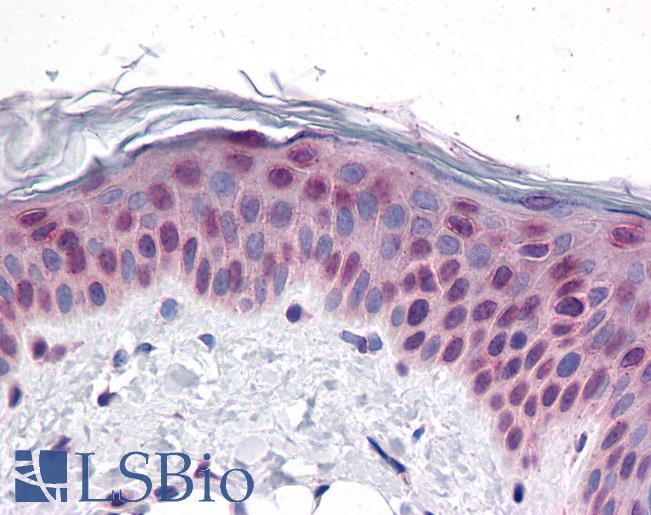 Anti-CCDC47 antibody IHC of human skin. Immunohistochemistry of formalin-fixed, paraffin-embedded tissue after heat-induced antigen retrieval. Antibody LS-B4623 concentration 5 ug/ml.