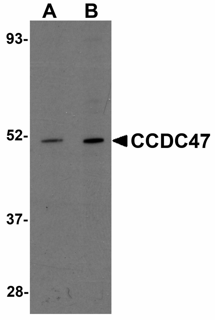 Western blot of CCDC47 in mouse heart tissue lysate with CCDC47 antibody at (A) 1 and (B) 2 ug/ml.