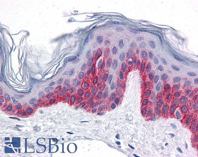 Anti-CCDC47 antibody IHC of human skin. Immunohistochemistry of formalin-fixed, paraffin-embedded tissue after heat-induced antigen retrieval. Antibody LS-B4622 concentration 5 ug/ml.