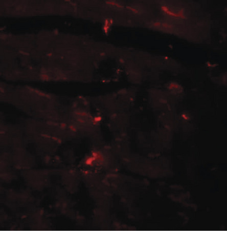 Immunofluorescence of CDCC47 in mouse heart tissue with CDCC47 antibody at 20 ug/ml.