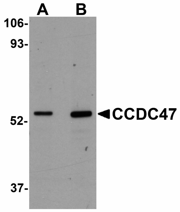 Western blot of CCDC47 in mouse heart tissue lysate with CCDC47 antibody at (A) 1 and (B) 2 ug/ml.