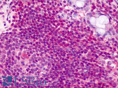 Anti-CCDC50 antibody IHC of human lymphocytes. Immunohistochemistry of formalin-fixed, paraffin-embedded tissue after heat-induced antigen retrieval. Antibody LS-B2294 concentration 5 ug/ml.