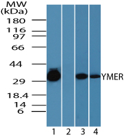 Western blot of Chromosome 3 open reading frame 6 (YMER) in human skeletal muscle lysate in the 1) absence, 2) presence of immunizing peptide, 3) mouse skeletal muscle and 4) rat skeletal muscle lysate using LS-C148450 at 0.05 ug/ml, 0.25 ug/ml and 0.25 ug/ml respectively.