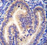 CCDC54 Antibody immunohistochemistry of formalin-fixed and paraffin-embedded human uterus tissue followed by peroxidase-conjugated secondary antibody and DAB staining.