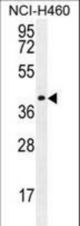 CCDC54 Antibody western blot of NCI-H460 cell line lysates (35 ug/lane). The CCDC54 antibody detected the CCDC54 protein (arrow).