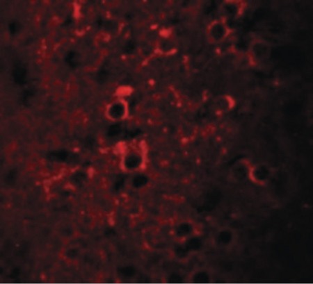 Immunofluorescence of CCDC55 in mouse brain cells with CCDC55 antibody at 20 ug/ml.