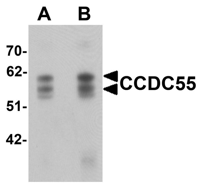 Western blot analysis of CCDC55 in human brain tissue lysate with CCDC55 antibody at (A) 0.5 and (B) 1 ug/ml