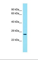 Western blot of Mouse Thymus. Ccdc59 antibody dilution 1.0 ug/ml.