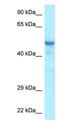 CCDC6 antibody Western Blot of Mouse Liver.