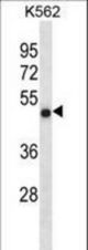 CCDC6 Antibody western blot of K562 cell line lysates (35 ug/lane). The CCDC6 antibody detected the CCDC6 protein (arrow).