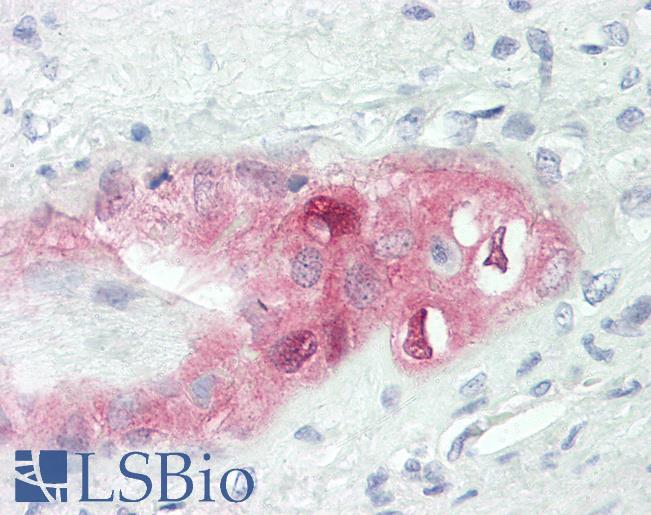 Human Placenta: Formalin-Fixed, Paraffin-Embedded (FFPE)