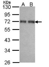 Sample (30 ug of whole cell lysate). A: H1299. B: Hela. 10% SDS PAGE. CCDC6 antibody diluted at 1:1000.
