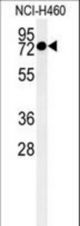 Western blot of CCDC62 Antibody in NCI-H460 cell line lysates (35 ug/lane). CCDC62 (arrow) was detected using the purified antibody.