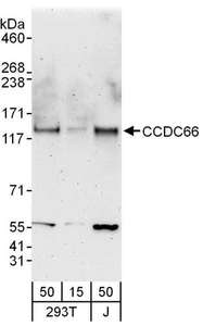 Detection of Human CCDC66 by Western Blot. Samples: Whole cell lysate from 293T (15 and 50 ug) and Jurkat (J; 50 ug) cells. Antibodies: Affinity purified rabbit anti-CCDC66 antibody used for WB at 0.1 ug/ml. Detection: Chemiluminescence with an exposure time of 3 minutes.