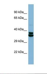 Western blot of Human ACHN. CCDC67 antibody dilution 1.0 ug/ml.