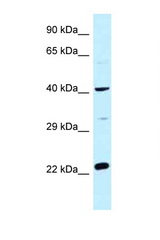 CCDC68 antibody LS-C145956 Western blot of Fetal Heart lysate. Antibody concentration 1 ug/ml.