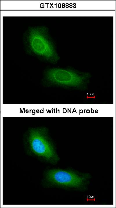 Immunofluorescence of paraformaldehyde-fixed HeLa using CCDC68 antibody at 1:200 dilution.