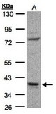 Sample (30 ug whole cell lysate). A: Raji . 10% SDS PAGE. CCDC68 / SE57-1 antibody diluted at 1:1000